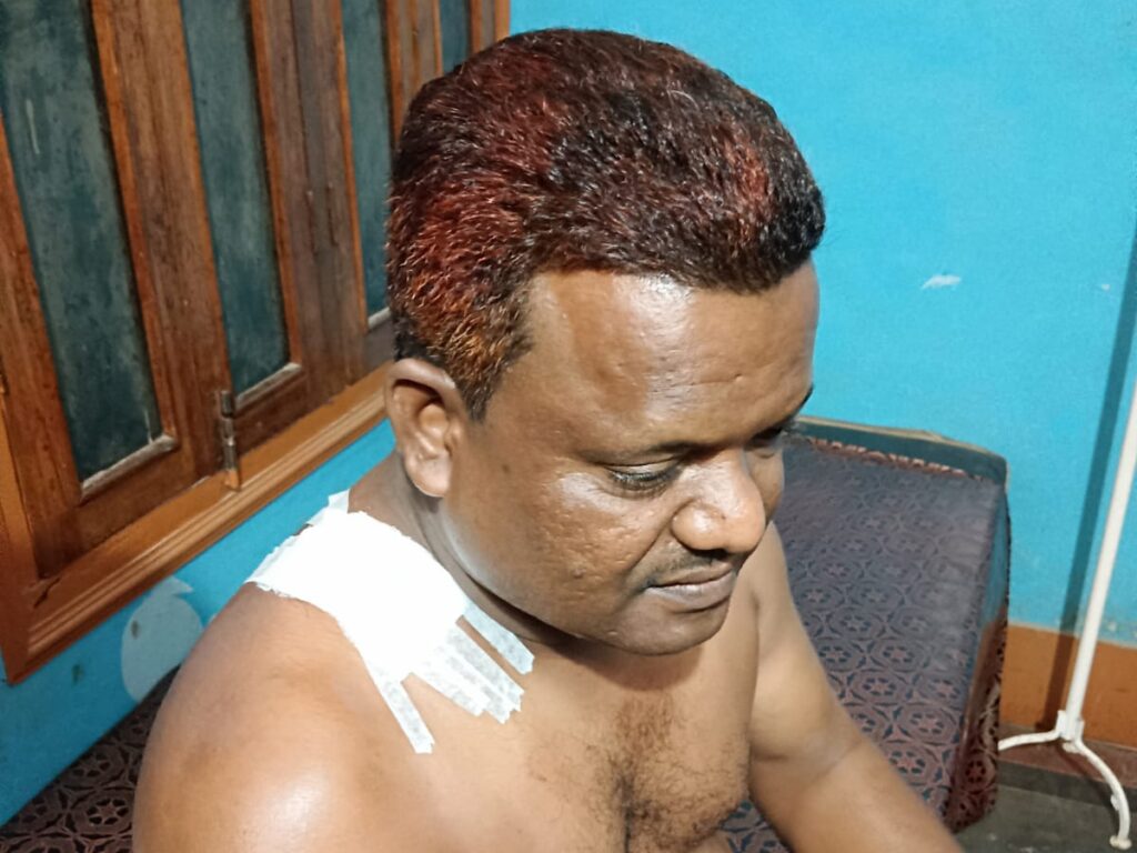 सक्ती:  नगर पंचायत उपाध्यक्ष पर कुल्हाड़ी से हमला: अस्पताल में भर्ती, पुरानी रंजिश में वारदात, फरार आरोपी की तलाश में जुटी पुलिस…