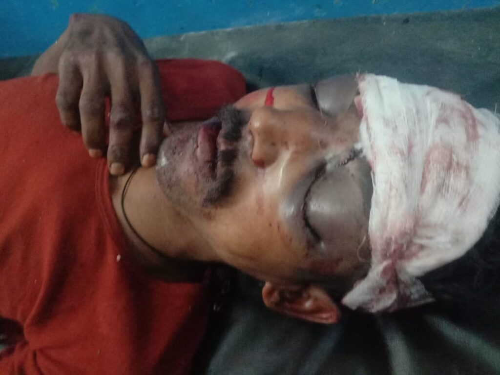 5 लोगों ने युवक को पीट-पीटकर मार डाला: बाइक से महिला को मारी थी टक्कर, 10 मीटर सड़क पर घिसटी, बच्चा दूर गिरा…