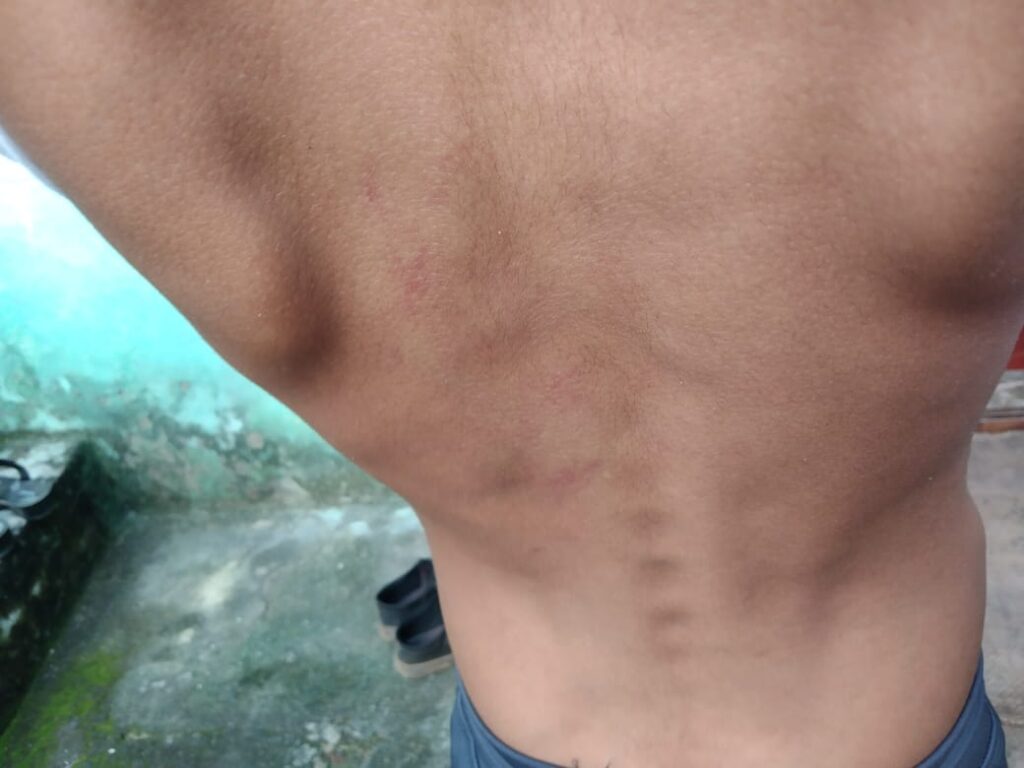 आधी रात को छात्र को अपने रूम में बुलाकर सीनियर छात्रों ने लात-घूंसे और स्केल से की जमकर पिटाई… सरकारी हॉस्टल में 6वीं के छात्र से हुई रैगिंग, छात्र के पिता ने प्राचार्य से की शिकायत..