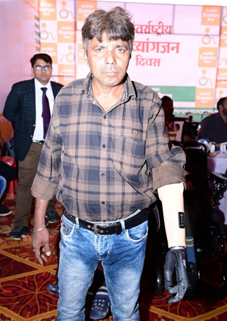 रायपुर : मोहन को जब मिला निःशुल्क कृत्रिम फंक्शनबेल हाथ, तो खिल उठा चेहरा, बोले अब सब कार्य स्वंय कर सकूंगा