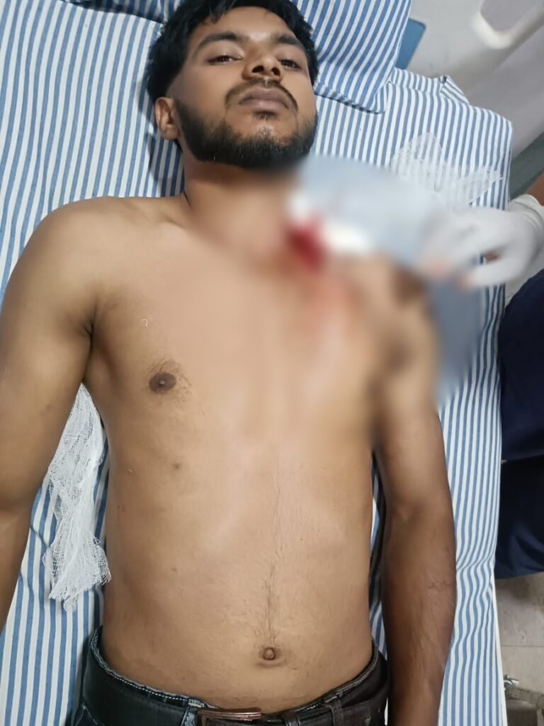 गांव की लड़की से दूर रहने की समझाइश दे रहे युवक के सीने पर चाकू से हमला..आरोपी और घायल रिश्ते में दोनों भाई…