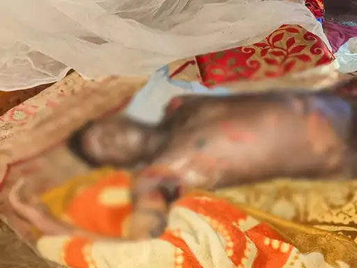 विवाद के बाद पत्नी पर कुल्हाड़ी से हमला, मरा समझकर पति ने खुद पर पेट्रोल छिड़कर लगा ली आग…महिला की हालत गंभीर…