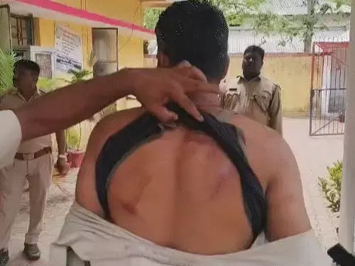 कोलेशन टैंक का निरीक्षण करने पहुंची वन विभाग की टीम पर ग्रामीणों ने लाठी-डंडों से किया हमला…50 से 60 ग्रामीणों ने दौड़ा-दौड़ा कर पीटा…डिप्टी रेंजर, वनपाल और दो फॉरेस्ट गार्ड घायल…5 ग्रामीण महिलाओं को भी आई चोटें