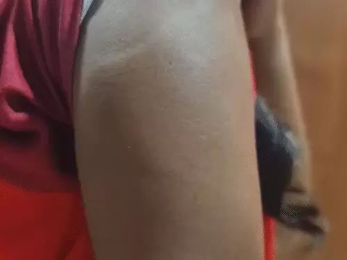 रफ कॉपी में नोट्स लिखने पर महिला टीचर ने 11वीं की छात्राओं को बांस की छड़ी से पीटा…हाथ में सूजन, पीठ पर पड़ गए निशान…