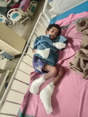 रायपुर : अबूझमाड़ के जंगल से निकालकर बीमार बचपन को जिला प्रशासन ने नई जिंदगी के लिए पहुंचाया रायपुर