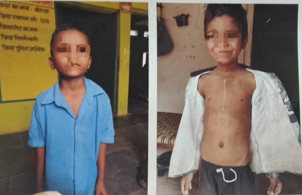 चिरायु योजना बनी संजीवनी, लक्ष्मीनारायण को मिला नया जीवन